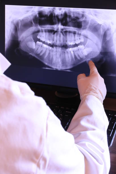 Best Emergency Treatment for Toothache in Hewitt, NJ