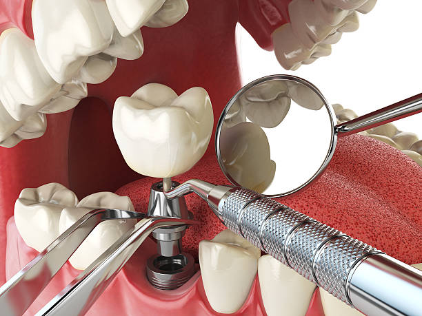 Best Emergency Dental Care for Trauma or Injury in Hewitt, NJ